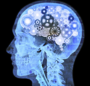 cerebro faxina sono solunni