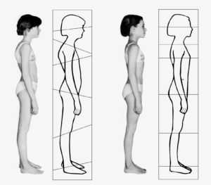 rolfingposture2